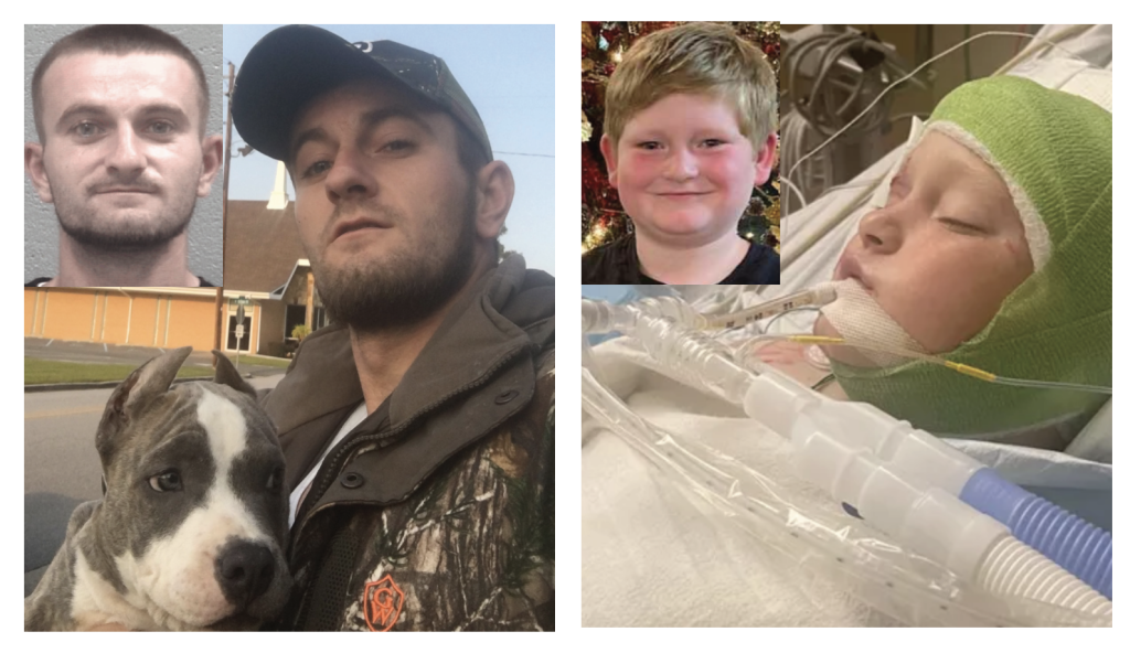 Columbia County addresses previous reports in aftermath of dog attack