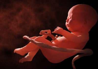 unborn fetus sonogram